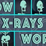 How do X-Rays Work?