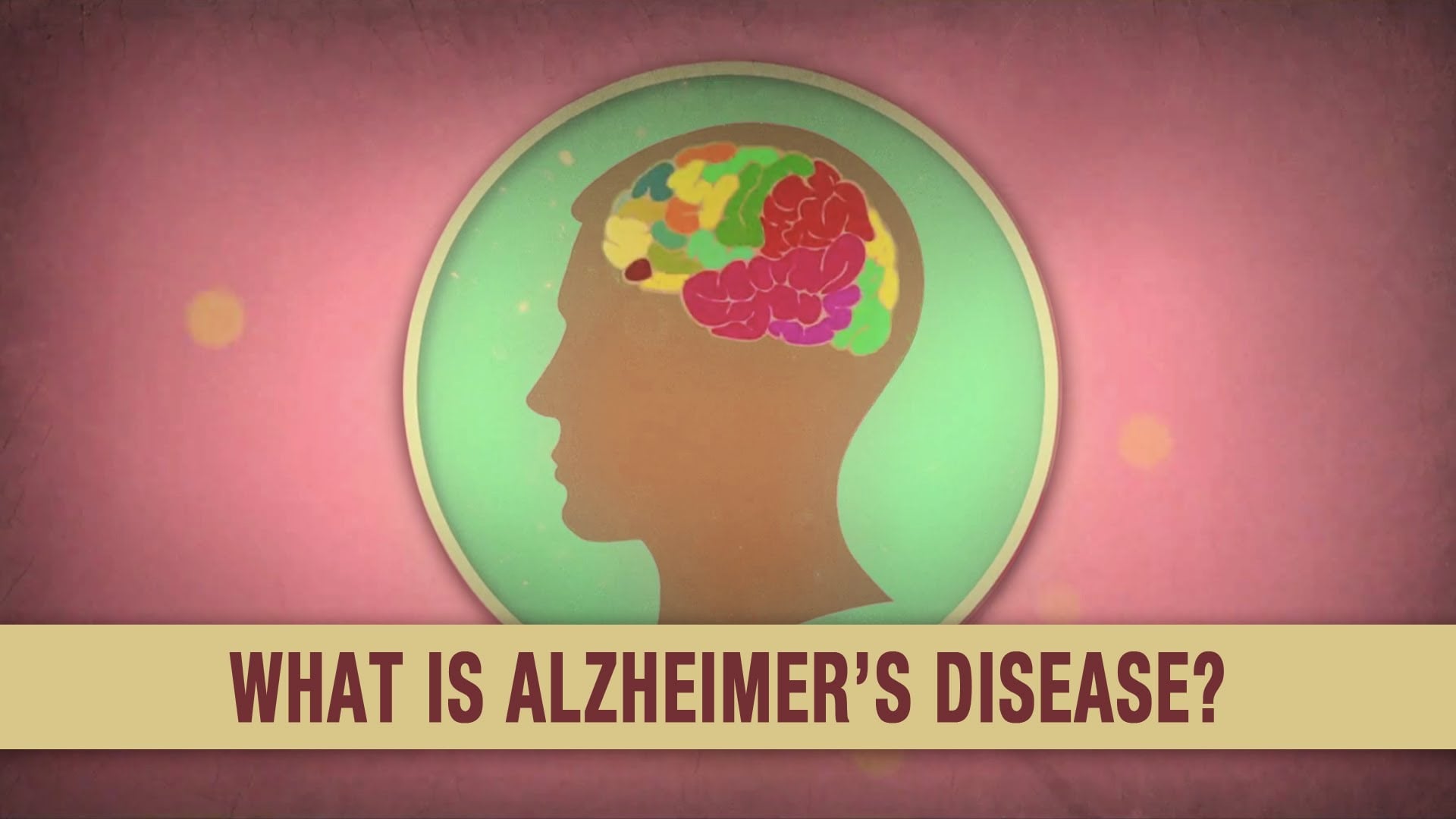 What is Alzheimer’s Disease?